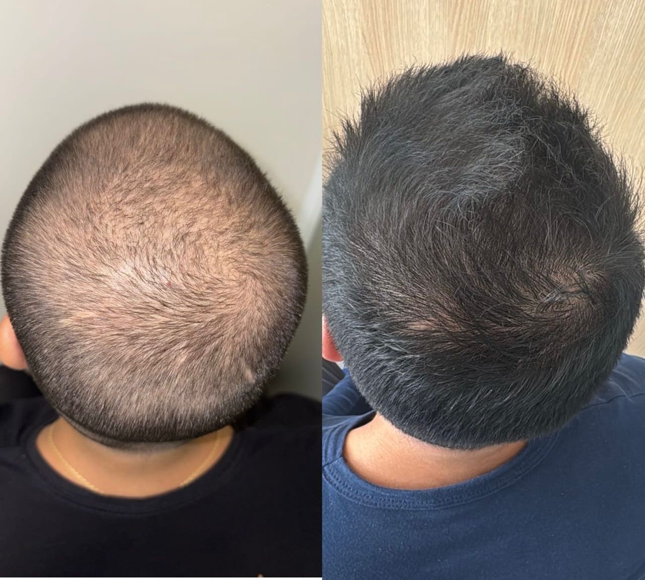 Resultado de tratamento - antes e depois