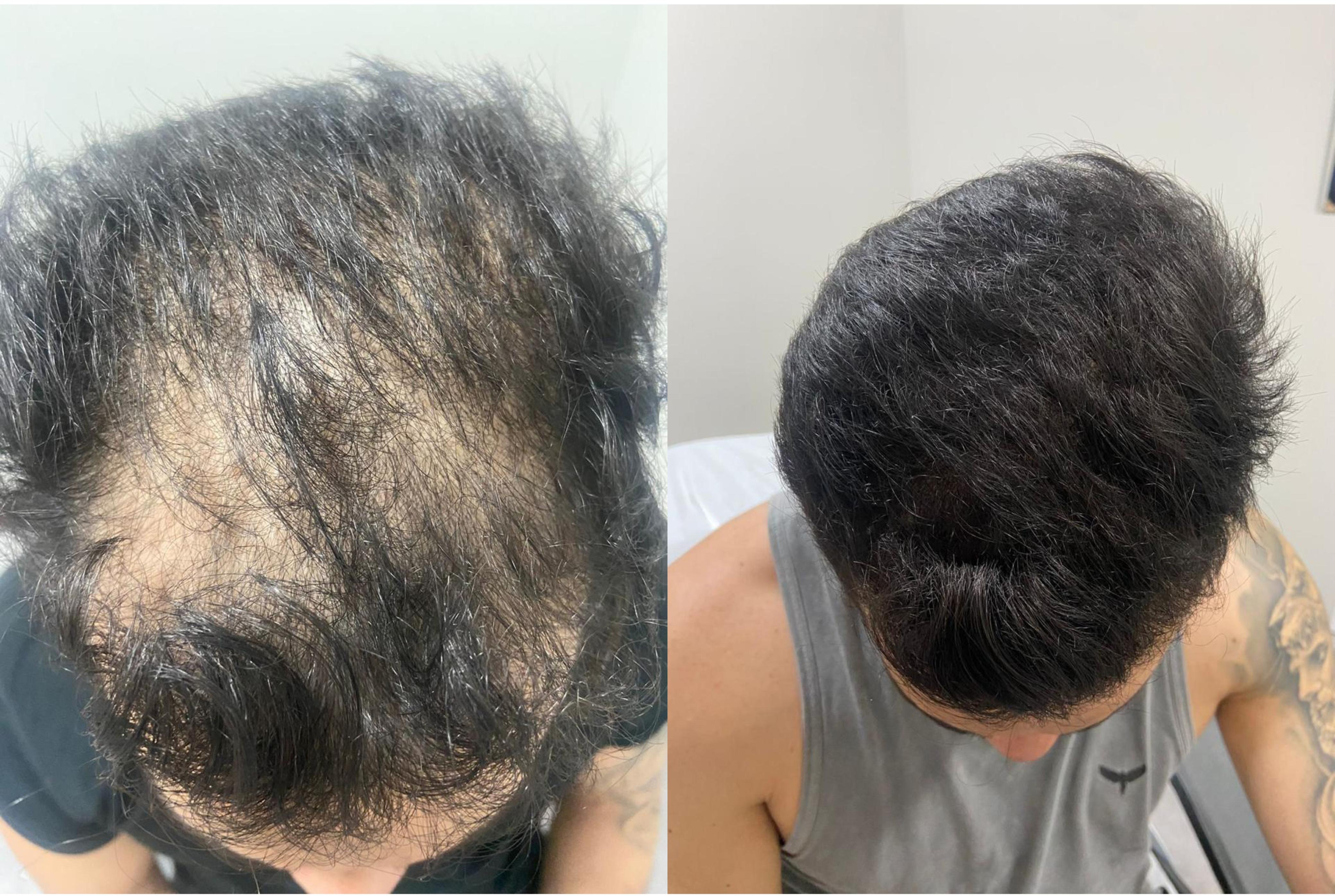 Resultado de tratamento - antes e depois